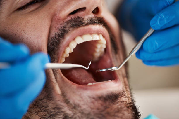 Best Emergency Tooth Extraction in Unicoi, TN